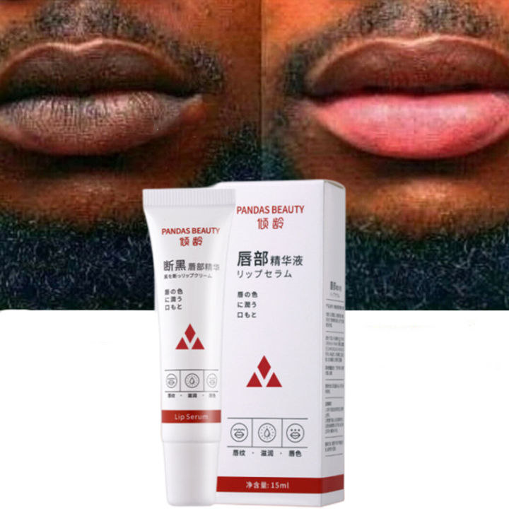 1PC Lips Pink Fresh Lightening Bleaching Cream Treatment Remove Dark Smoke Lips Lip Balm