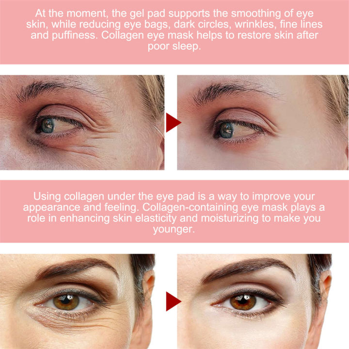 1-30%20Pairs%20Rose%20Essence%20Eye%20Patches%20Anti-aging%20Hydrating%20Effective%20Remove%20Dark%20Circles%20Wrinkle%20Eyes%20Masks%20Eye%20Skin%20Care%20Products%20-%20Image%205