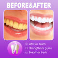 【Popular Categories】 Oralhoe 120g Sp7 Toothpaste Bleach Yellow Teeth Relieve Swollen Gum Fresh Breath Repair Decay Whiten Tooth Toothpaste. 