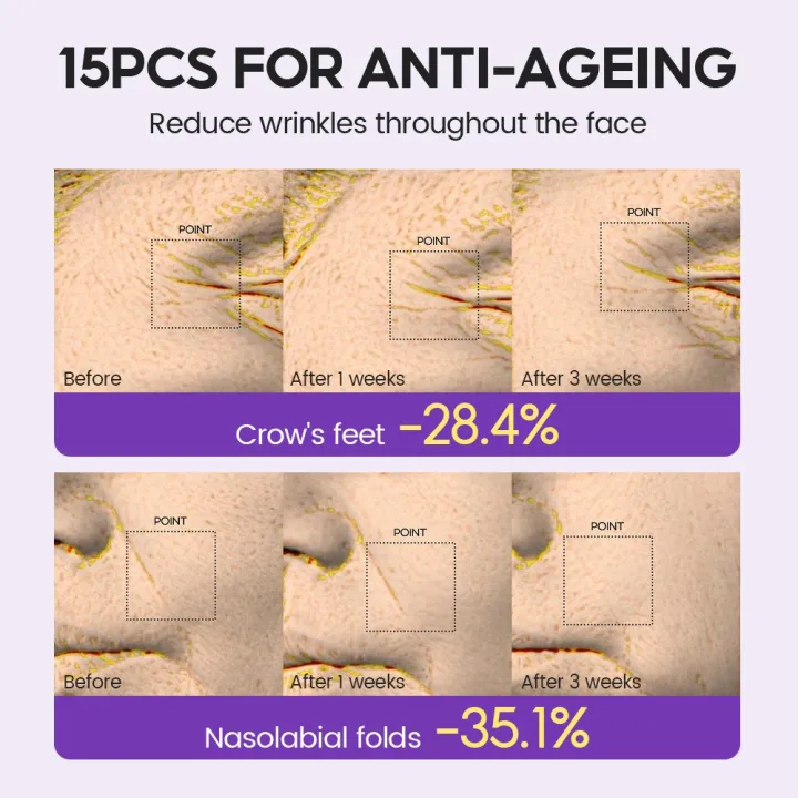 Retinol%20+%20Pro-xylane%20Ampoule%20serum%20It%20Soothes%20Repairs%20Strengthens%20The%20Skin%20And%20Diminishes%20Fine%20Lines%20-%20Image%203