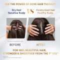 Dove Hair Therapy Sensitive Scalp Care Serum + Conditioner 230ml SAB (FROM MALAYSIA). 
