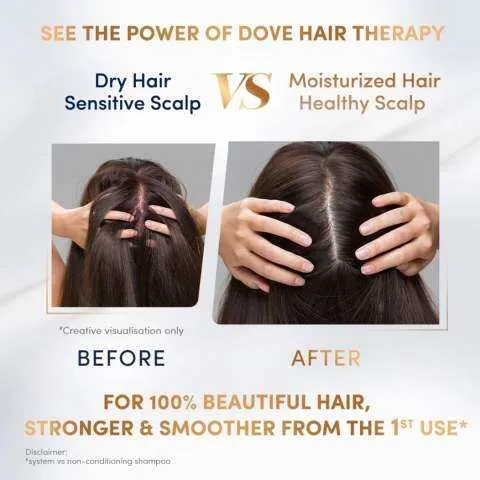 Dove%20Hair%20Therapy%20Sensitive%20Scalp%20Care%20Serum%20+%20Conditioner%20230ml%20SAB%20(FROM%20MALAYSIA)%20-%20Image%202