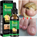 7 Day Nail Fungal Treatment Serum Foot Toe Nail Fungus Removal Essential Oil Infection Onychomycosis Paronychia Repair Gel. 