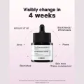 COSRX The Niacinamide 15 Serum. 