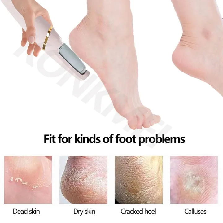 Electric%20Foot%20Callus%20Remover,%20Rechargeable%20Portable%20Electronic%20Foot%20File%20Pedicure,%20Waterproof%20Foot%20Scrubber%20File,%20Professional%20Pedicure%20Tools,%20Foot%20Care%20for%20Dead%20Skin%20Ideal%20Gift,%202%20Rollers%20-%20Image%205