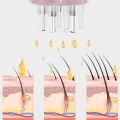 Portable Head Fluid Brush Scalp Applicator Essential Oil Liquid Guiding Massager Comb Scalp Applicator Liquid Comb for Hair Scalp Treatment Hair Growth Serum Oil Apply. 