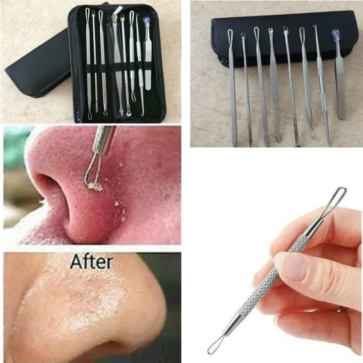 Waitz%20Naitz%207/9pcs%20Stainless%20Steel%20Blackhead%20Remover%20Tool%20Set%20Whitehead%20PiHot%20Selling%20mple%20Spot%20Comedone%20Acne%20Extractor%20Remover%20Popper%20Face%20Tools%20Kit%20-%20Image%204