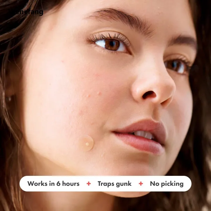 Wenefang%20Fifty%20percent%20discount%20Chin%20Acne%20Pimple%20Patch%20Sticker%20Acne%20Treatment%20Pimple%20Remover%20Tool%20Blemish%20Spot%20Face%20Repair%20Patch%20Skin%20Care%20Waterproof%2036%20Patches%20-%20Image%203