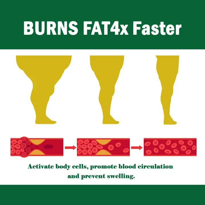 Leg%20Swelling%20Relief%20Cream%20Joint%20Soreness%20Pain%20Therapy%20Legs%20Edema%20Treatment%20Slimming%20Detoxifying%20Dehumidification%20Care%20Product%20-%20Image%205