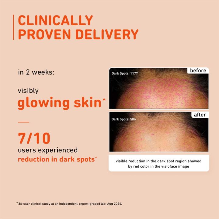 Plum%2015%25%20Vitamin%20C%20Face%20Serum%2020%20ml%20-%20Image%205