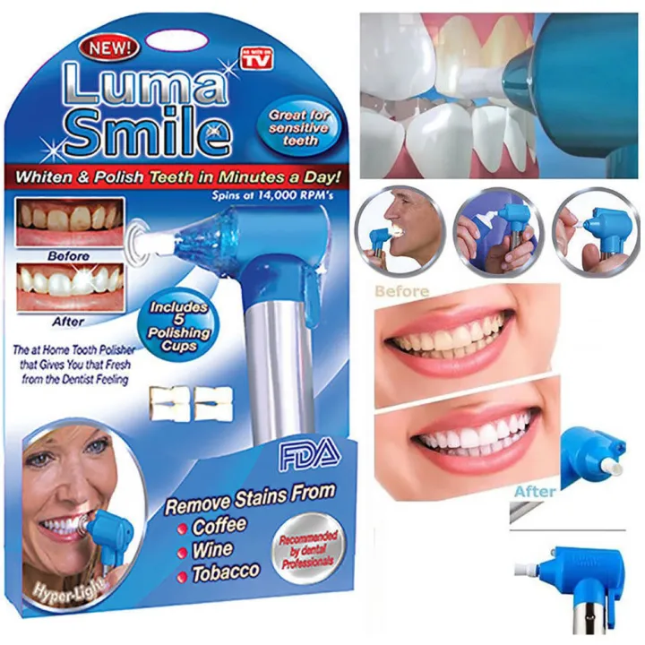 Luma Smile Teeth Polisher