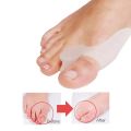 2PCS Silicone Gel Thumb Corrector Bunion Foot Toe Hallux Valgus Protector Separator Finger Straightener Adjuster Foot Care Tool. 