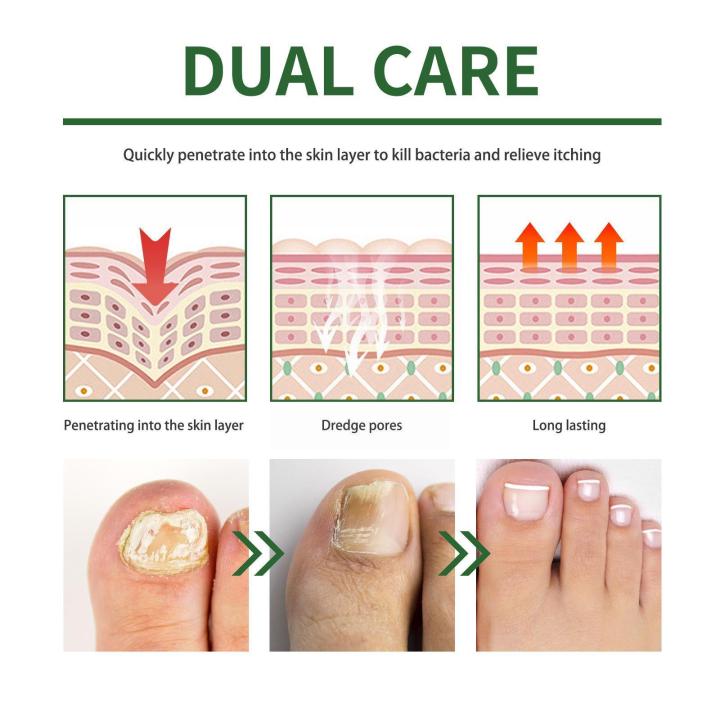 1%20Pair%20Foot%20Peel%20Mask%20Feet%20Exfoliating%20Mask%20Foot%20Spa%20Socks%20Scrub%20For%20Remove%20Dead%20Skin%20Exfoliating%20Heels%20Foot%20Peeling%20Mask%20Y9M6%20-%20Image%204