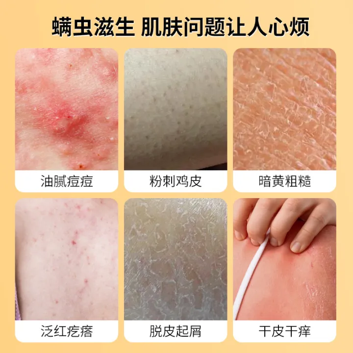 400ml%20Shower%20Gel%20Sulfur%20Liquid%20Mite%20Removal%20Soap%20Cleaner%20Bar%20Soap%20Acne%20Treatment%20Reduce%20Oil%20Keeps%20Pores%20Cleaner%20Hand%20Sulfur%20Soap%20-%20Image%204