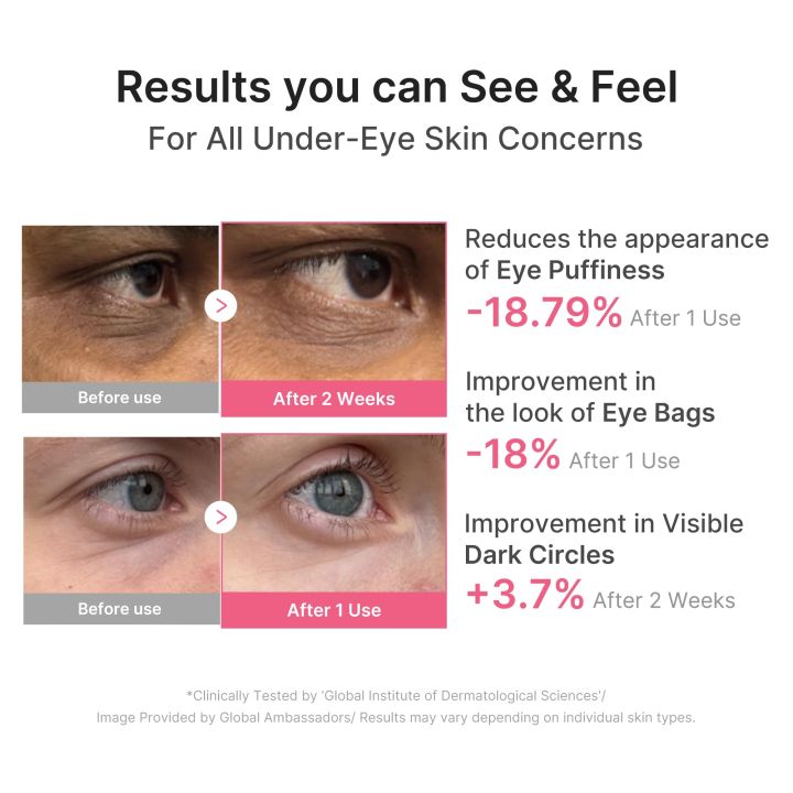 Medicube%20PDRN%20Eye%20Patch%20Caffeine%20Dark%20Circle%20Care%2060%20Pairs%20-%20Image%204