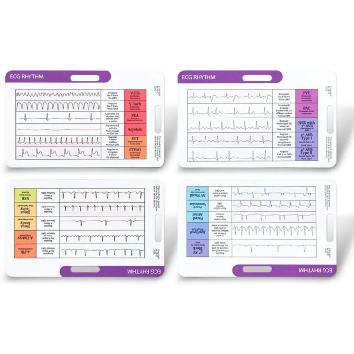 High Quality Quick Reference EKG Rhythm Interpretation Card Dual-Sided ...