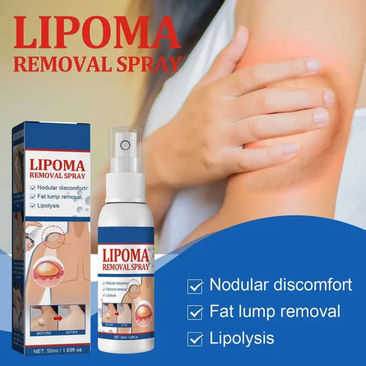 Lipoma%20Removal%20Spray%20Anti%20Tumor%20Skin%20Swelling%20Pain%20Lipolysis%20Cellulite%20Treatment%20Fibroma%20Subcutaneous%20Fat%20Lump%20Relief%20Cream%2050ml%20-%20Image%205