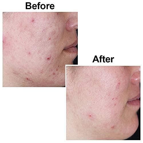 KOJIE%20SAN%20SKIN%20LIGHTENING%20KOJIE%20ACID%20SOAP%20Skin%20Lightening%20and%20Whitening%20Classic%20Soap%20135g%20-%20Image%208