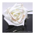【Super Sale】Kiss me Letter Anklet 14K Rose Color Titanium Steel Anti-allergy Fading Sun Yunyun Nonsense. 