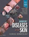 Andrews' Diseases of the Skin: Clinical Dermatology. 