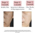 BLUSHLIN 10% Tranexamic Acid Cream with 2% Kojic Acid + 5% Vitamin C + 1% Arbutin | Pigmentation Removal Face Cream | Helps Even Skin Tone, Reduce Dark Spots, Blemishes and Scars - 10gm(FROM INDIA)JEZ. 