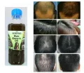 Ayurvedic 100% Natural Hair Growth Oil for Men, Women, & Children - 200ml". 