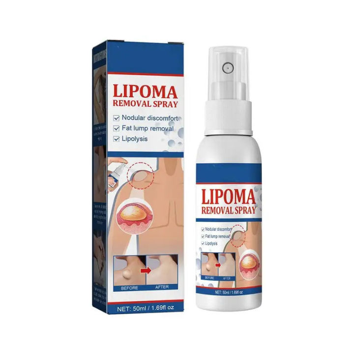 Lipoma%20Removal%20Spray%20Anti%20Tumor%20Skin%20Swelling%20Pain%20Lipolysis%20Cellulite%20Treatment%20Fibroma%20Subcutaneous%20Fat%20Lump%20Relief%20Cream%2050ml%20-%20Image%206