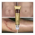TCM Scar And Acne Mark Removal Gel Ointment Cream. 
