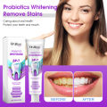 【Popular Categories】 Oralhoe 120g Sp7 Toothpaste Bleach Yellow Teeth Relieve Swollen Gum Fresh Breath Repair Decay Whiten Tooth Toothpaste. 