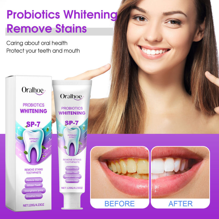 %E3%80%90Popular%20Categories%E3%80%91%20Oralhoe%20120g%20Sp7%20Toothpaste%20Bleach%20Yellow%20Teeth%20Relieve%20Swollen%20Gum%20Fresh%20Breath%20Repair%20Decay%20Whiten%20Tooth%20Toothpaste%20-%20Image%202