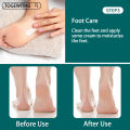 Callus Remover for Feet, Double-Sided Foot Files Stainless Steel Foot Rasp Dead Skin Callous Scraper Professional Pedicure Tool. 