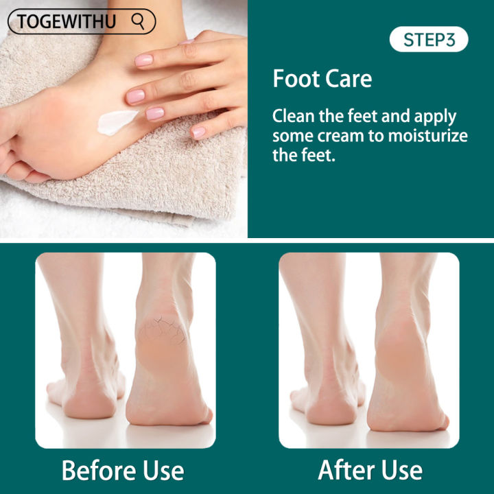 Callus%20Remover%20for%20Feet,%20Double-Sided%20Foot%20Files%20Stainless%20Steel%20Foot%20Rasp%20Dead%20Skin%20Callous%20Scraper%20Professional%20Pedicure%20Tool%20-%20Image%206