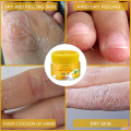 Foot crack repair and dryness healing cream 20g big pack Natural ingredients. 