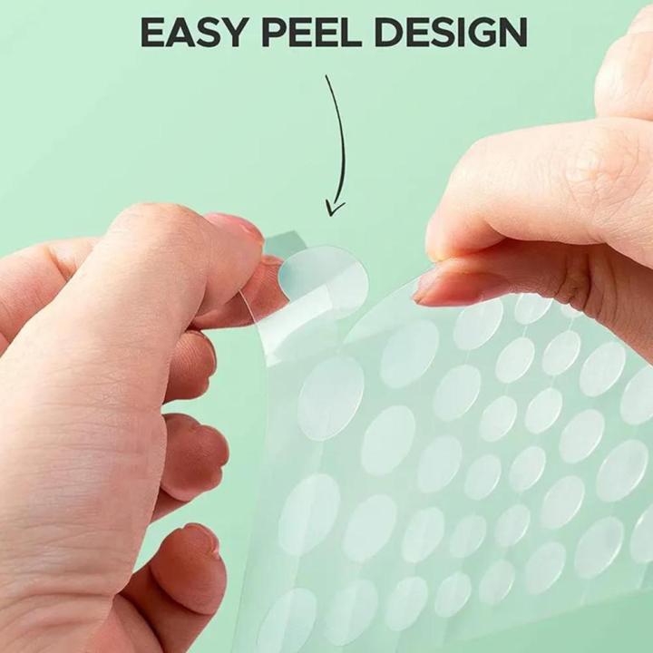 Tea%20Tree%20Essential%20Acne%20Patches%20Waterproof%20Pimple%20Patch%20for%20Control,%20Redness%20Repair,%20Whitehead%20Improvement%20Skin%20Care%20-%20Image%203