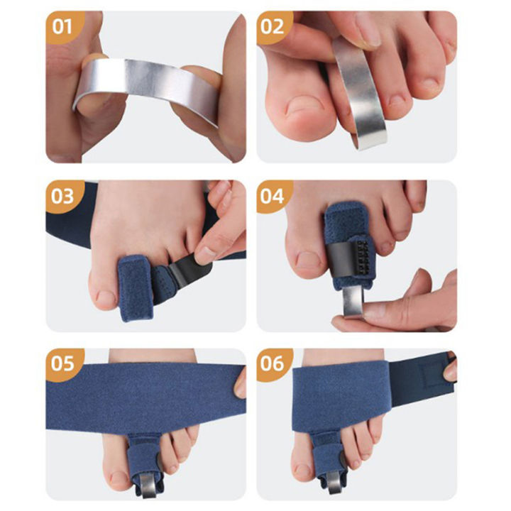 %E3%80%90GlowBound%E3%80%91Finger%20Toe%20Straightener%20Toe%20Splint%20Corrector%20Toe%20Wrap%20For%20Hammer%20Toe%20Bent%20Claw%20And%20Crooked%20Toe%20To%20Align%20Support%20Toes%20Foot%20Care%20-%20Image%205