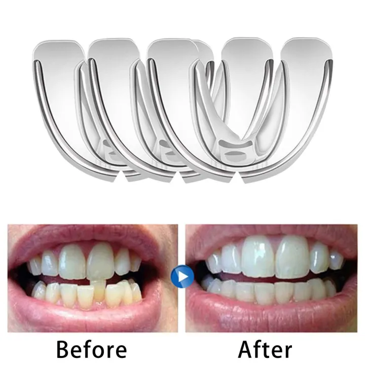 Professional Alignment Braces Oral Hygiene Dental Care Equipment For Teeth..