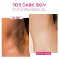 Body Brightening Cream Lightening Elbow and Knee Joint Black Exfoliating Cream Improving Dark Inner Thigh Skin Under Armpit. 