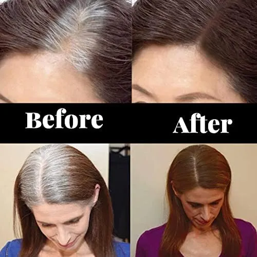 NALACAL%20Root%20Touch%20Up,%20Hair%20Dye%20Pen,%20Root%20Cover%20Up%20Black,%20Hairline%20Powder%20Stick,%20Haircolor%20Touch-Up%20Stick%20to%20Cover%20Gray%20Hair%20Root,%20Semi-permanent%20Root%20Hair%20Coloring%20(Brown)FROM%20DUBAI(SAM)%20-%20Image%204