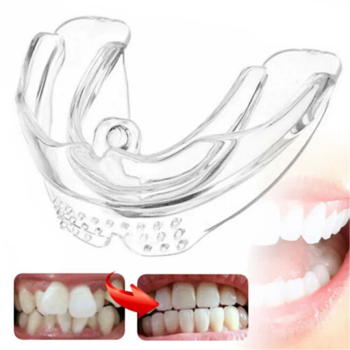 【Hot】 Orthodontic Braces Appliance Dental Braces Silicone Alignment Trainer Teeth Retainer Bruxism Mouth Duard Teeth Straightener