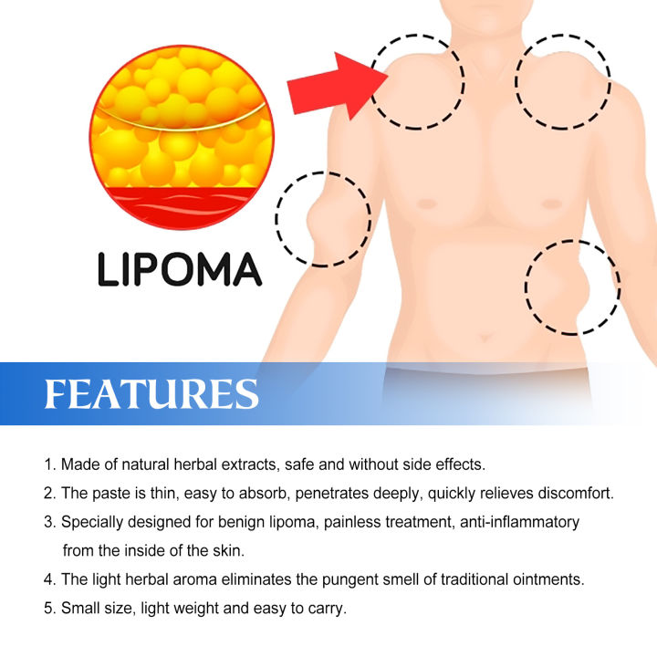 Lipoma%20Removal%20Cream%20Relief%20Pain%20Treat%20Skin%20Swelling%20Lipolysis%20Cellulite%20Fat%20Lump%20Nodule%20Removal%20Ointment%20Anti-tumor%20Plaster%20-%20Image%205