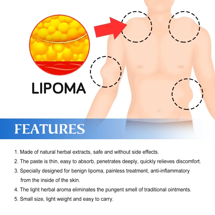 Lipoma%20Removal%20Cream%20Relief%20Pain%20Treat%20Skin%20Swelling%20Lipolysis%20Cellulite%20Fat%20Lump%20Nodule%20Removal%20Ointment%20Anti-tumor%20Plaster%20-%20Image%205