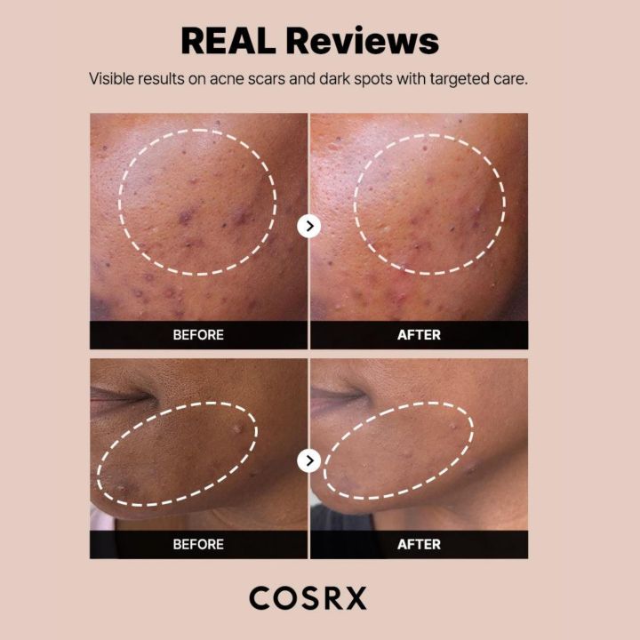 COSRX%20The%20Alpha-Arbutin%202%20Discoloration%20Care%20Serum%2050ml%20-%20Image%203