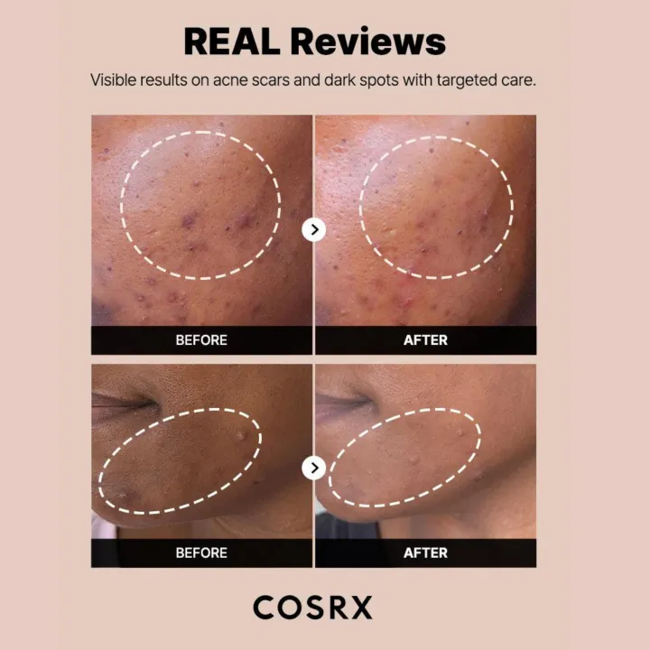 COSRX%20The%20Alpha-Arbutin%202%20Discoloration%20Care%20Serum%2050ml%20-%20Image%203
