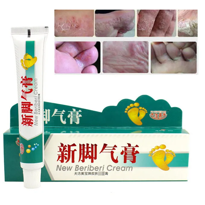 Relieve%20Itch%20Tinea%20Pedis%20Ointment%2015g,%20Beriberi%20Cream,%20Athlete's%20Foot%20Toe%20Fungus%20Ringworm%20Itching%20Infection%20Paronychia%20Treatment%20-%20Image%208