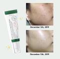 Axis-Y Dark Spot Correcting Glow Serum. 