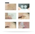 Skynlab Acne Patch (10 Pcs). 