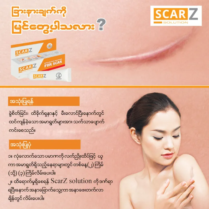 SCAR%20Z%20SCAR%20TREATMENT%2012G%20-%20Image%203