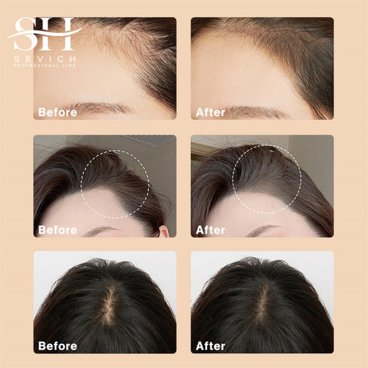 (Preorder)%20SEVICH%20Hair%20Shadow%20Powder%20Waterproof%20Hair%20Color%20Concealer%20Powder%20-%20Image%202