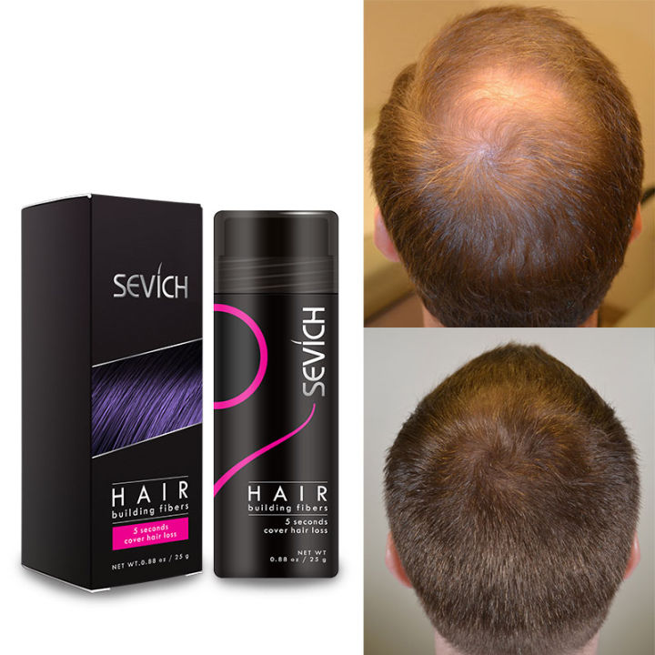 (Preorder)%20Sevich%202pcs%2025g%20bald%20hair%20closure%20fiber%20powder%20(black)%20hair%20building%20fiber%20dyeing%20-%20Image%204