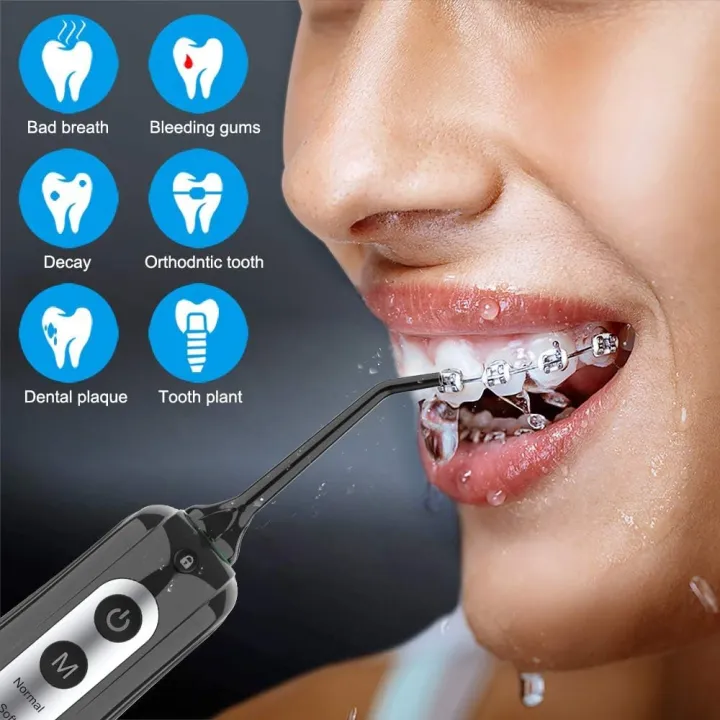 Cordless%20Water%20Dental%20Flosser%20Teeth%20Cleaner,%20INSMART%20Professional%20300ML%20Tank%20DIY%20Mode%20USB%20Rechargeable%20Dental%20Oral%20Irrigator%20for%20Home%20and%20Travel,%20IPX7%20Waterproof%206%20Modes%20Irrigate%20for%20Oral%20Care%20-%20Image%203